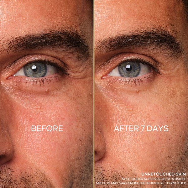 TRATAMIENTO DE OJOS REPARADOR DE...